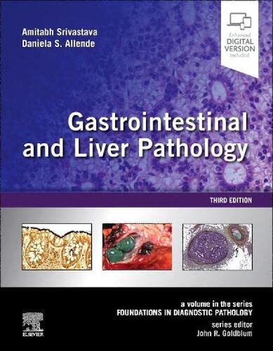 Gastrointestinal and Liver Pathology: A Volume in the Series: