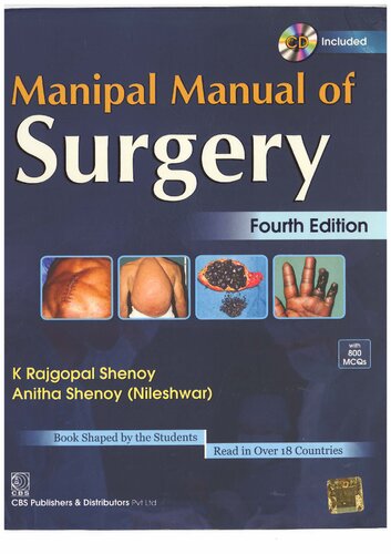 Manipal Manual of Surgery