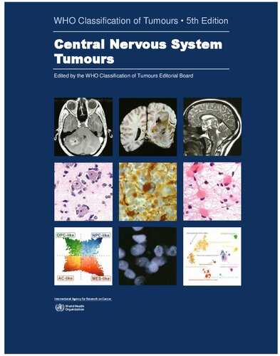 - Central Nervous System Tumours, 5th Edition