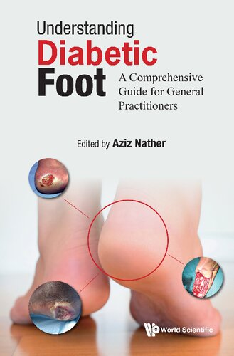 Understanding Diabetic Foot: A Comprehensive Guide For General Practitioners