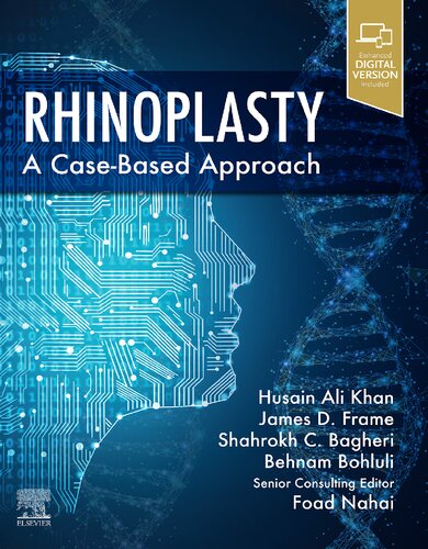 Rhinoplasty: A Case-Based Approach