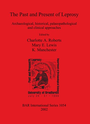 The Past and Present of Leprosy: Archaeological, historical, palaeopathological and clinical approaches