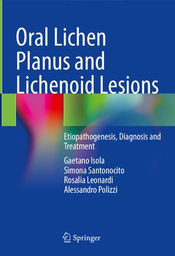 Oral Lichen Planus and Lichenoid Lesions: Etiopathogenesis, Diagnosis and Treatment