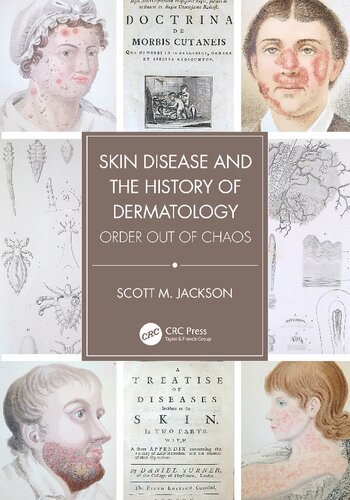 Skin Disease and the History of Dermatology: Order out of Chaos