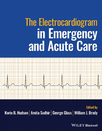 The Electrocardiogram in Emergency and Acute Care