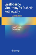 Small-Gauge Vitrectomy for Diabetic Retinopathy