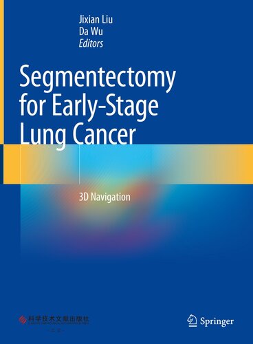 Segmentectomy for Early-Stage Lung Cancer: 3D Navigation