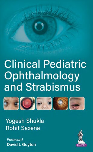 Clinical Pediatric Ophthalmology and Strabismus