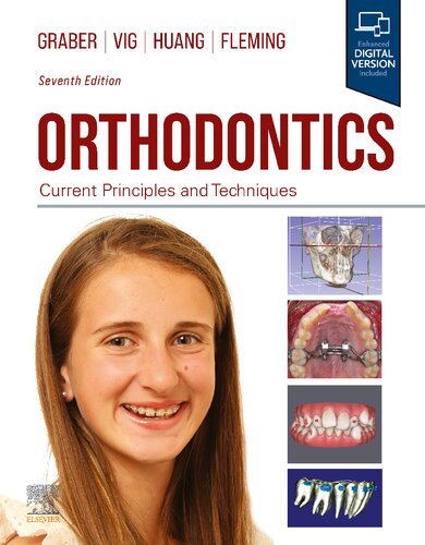 Orthodontics: Current Principles and Techniques