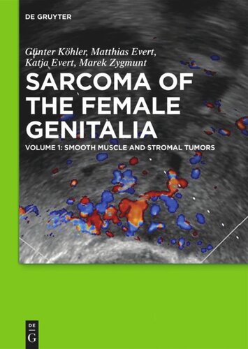 Sarcoma of the Female Genitalia: Volume 1 Smooth muscle and stromal tumors and prevention of inadequate surgery