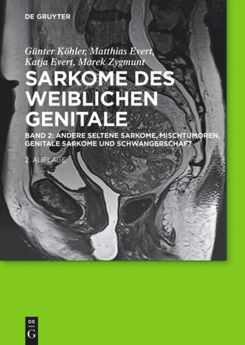 Sarkome des weiblichen Genitale: Band 2 Andere seltene Sarkome,  Mischtumoren, genitale Sarkome und Schwangerschaft