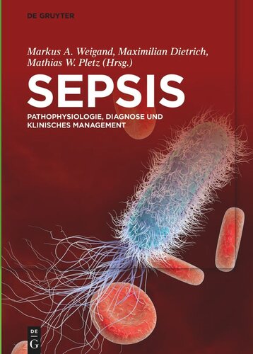 Sepsis: Pathophysiologie, Diagnose und klinisches Management