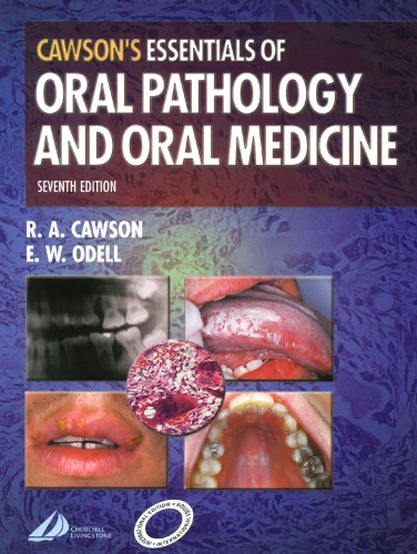 Cawson's Essentials of Oral Pathology and Oral Medicine