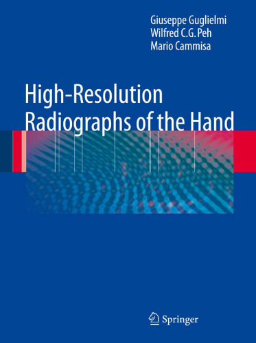 High-Resolution Radiographs of the Hand