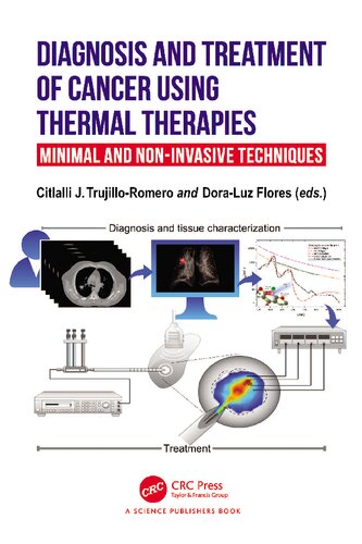 Diagnosis and Treatment of Cancer using Thermal Therapies: Minimal and Non-invasive Techniques [Team-IRA]