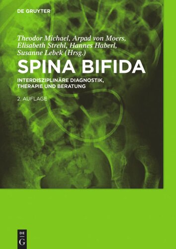 Spina bifida: Interdisziplinäre Diagnostik, Therapie und Beratung