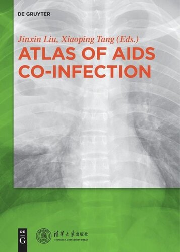 Atlas of AIDS Co-infection