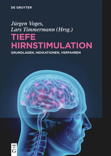 Tiefe Hirnstimulation: Grundlagen, Indikationen, Verfahren