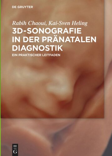 3D-Sonografie in der pränatalen Diagnostik: Ein praktischer Leitfaden