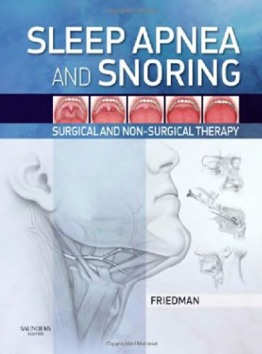 Sleep Apnea and Snoring: Surgical and Non-Surgical Therapy