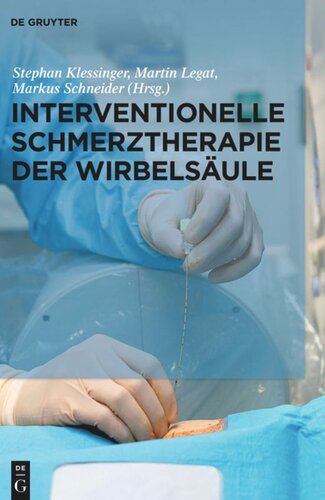 Interventionelle Schmerztherapie der Wirbelsäule