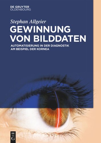 Gewinnung von Bilddaten: Automatisierung in der Diagnostik am Beispiel der Kornea