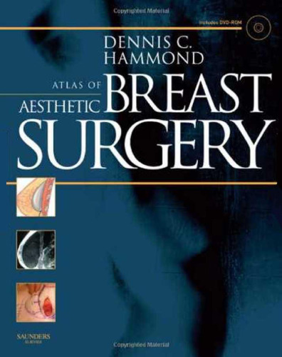 Atlas of Aesthetic Breast Surgery