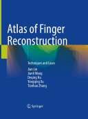 Atlas of Finger Reconstruction: Techniques and Cases