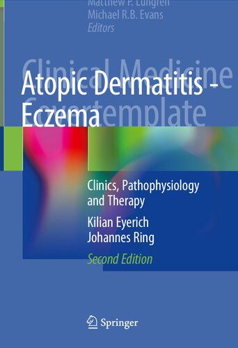 Atopic Dermatitis - Eczema: Clinics, Pathophysiology and Therapy