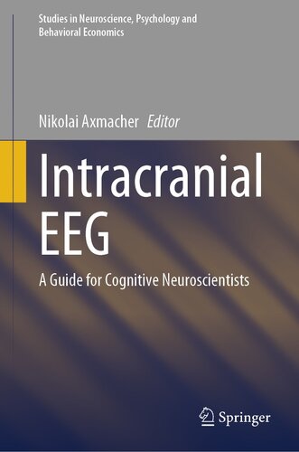 Intracranial EEG: A Guide for Cognitive Neuroscientists