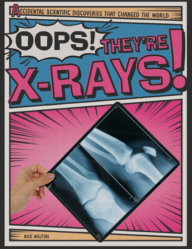 Oops! They're X-Rays!