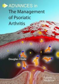 Advances in the Management of Psoriatic Arthritis