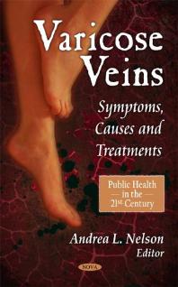 Varicose Veins: Symptoms, Causes and Treatments : Symptoms, Causes and Treatments