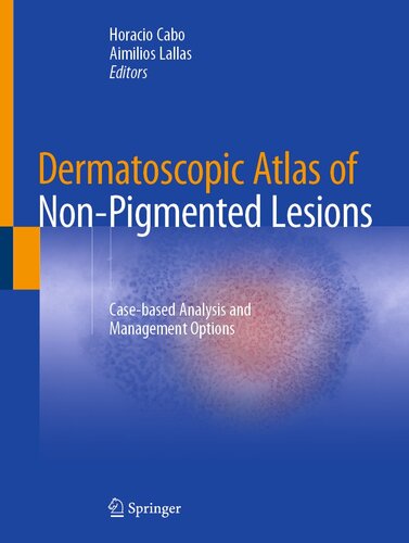 Dermatoscopic Atlas of Non-Pigmented Lesions : Case-based Analysis and Management Options