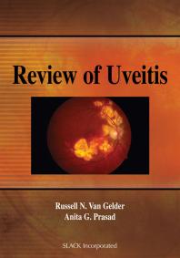 Review of Uveitis