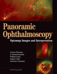 Panoramic Ophthalmoscopy : Optomap® Images and Interpretation