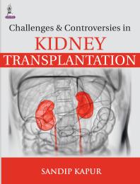 Challenges and Controversies in Kidney Transplantation