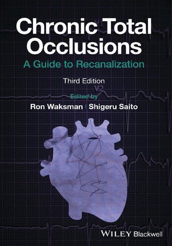 Chronic Total Occlusions: A Guide to Recanalization [Team-IRA]