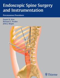 Endoscopic Spine Surgery and Instrumentation