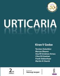 Urticaria