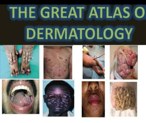 great atlas of dermatology indexed