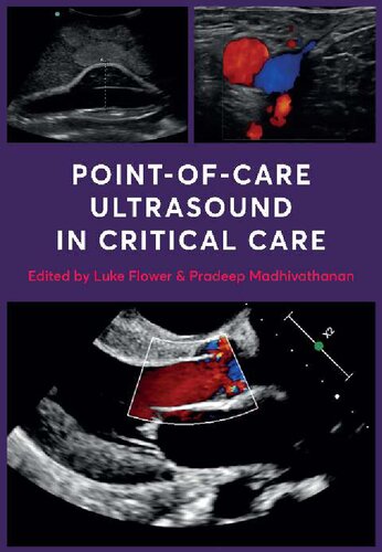 Point-of-Care Ultrasound in Critical Care [Team-IRA]