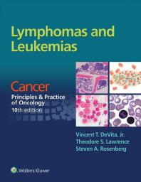 Lymphomas and Leukemias: Cancer: Principles and Practice of Oncology, 10th Edition