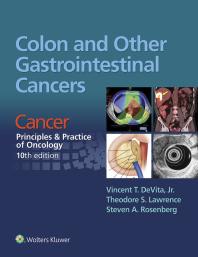 Colon and Other Gastrointestinal Cancers: Cancer: Principles and Practice of Oncology, 10th Edition