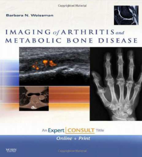 Imaging of Arthritis and Metabolic Bone Disease: Expert Consult - Online and Print