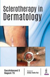 Sclerotherapy in Dermatology