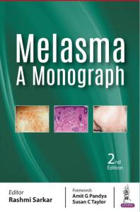 Melasma: a Monograph