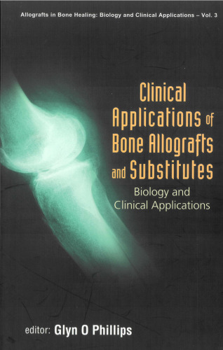 Clinical Applications of Bones: Allografts and Substitutes