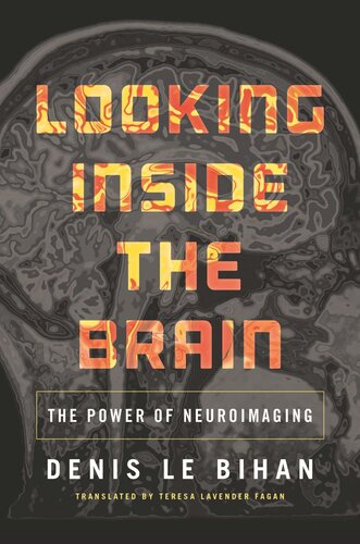 Looking Inside the Brain: The Power of Neuroimaging