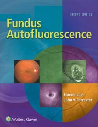 Fundus Autofluorescence